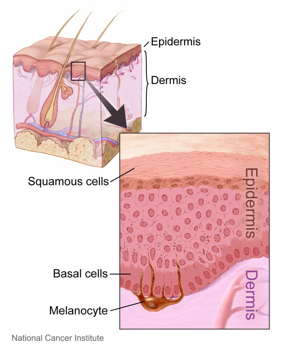 Labeled diagram of the skin showing the epidermis and dermis, with a close-up of squamous cells, basal cells and a melanocyte